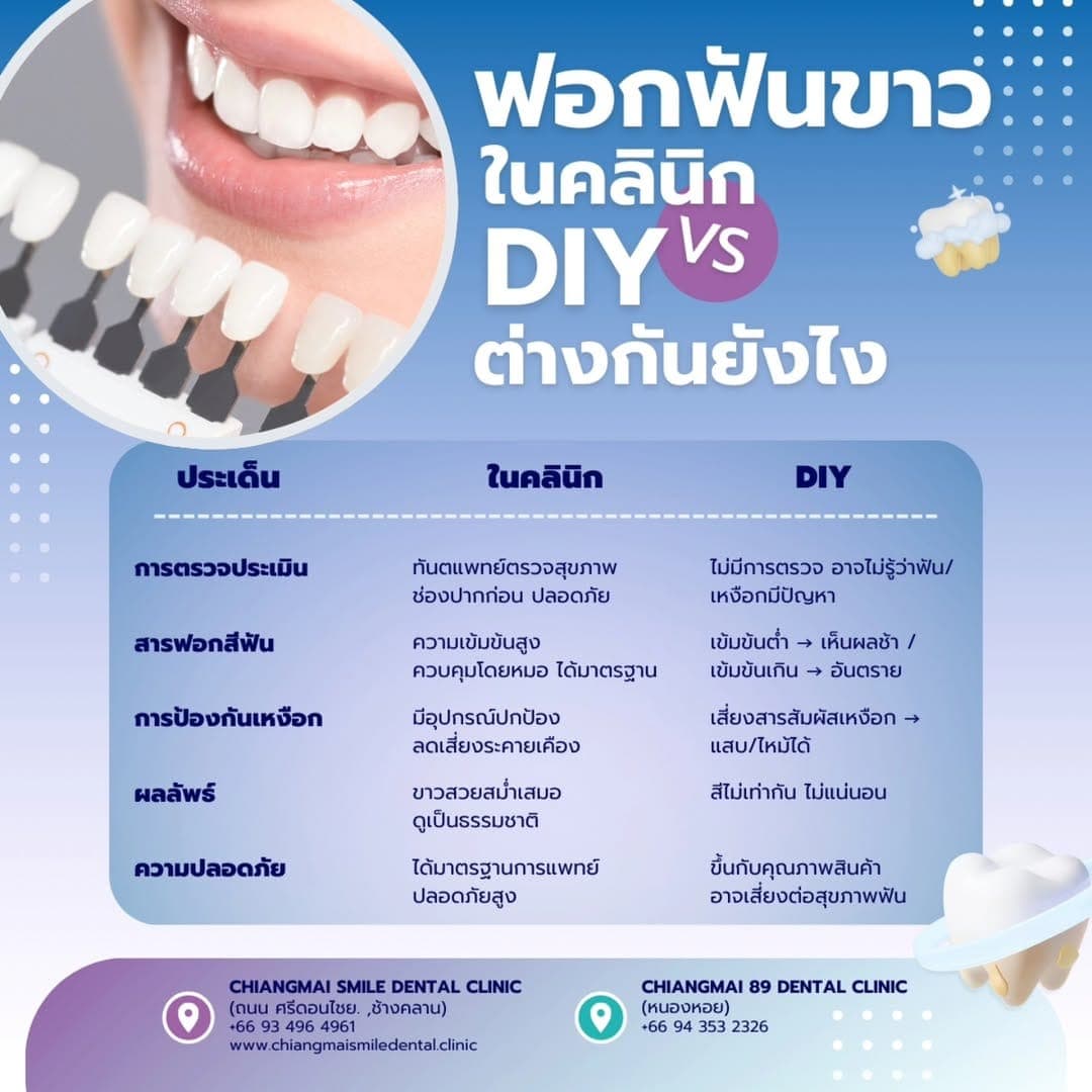 ฟอกฟันขาวในคลินิก Vs DIY ต่างกันยังไง