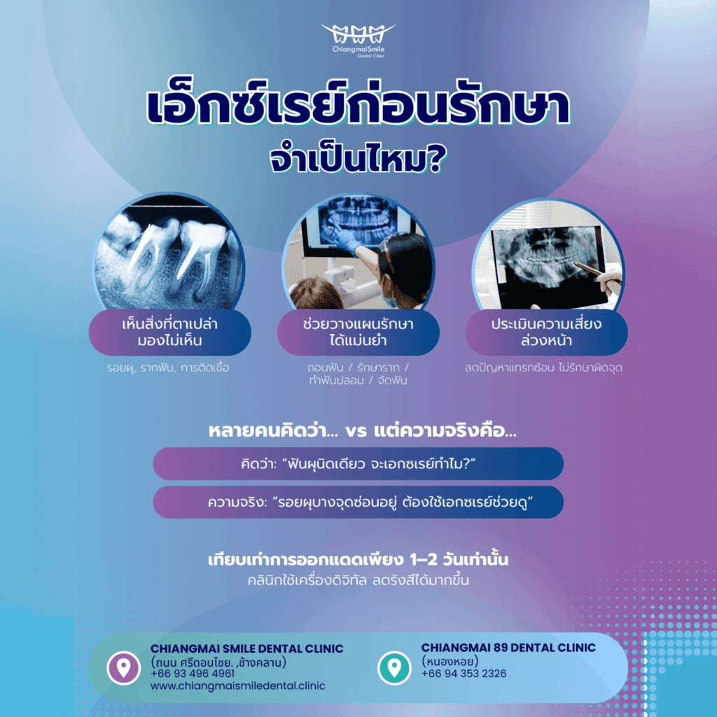 ทำไมต้องเอ็กซ์เรย์ฟันก่อนรักษา? สำคัญแค่ไหน มาหาคำตอบกัน!