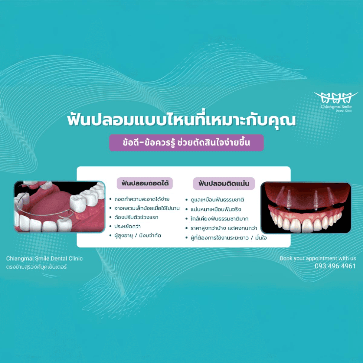 ฟันปลอมแบบไหน ที่เหมาะกับคุณ