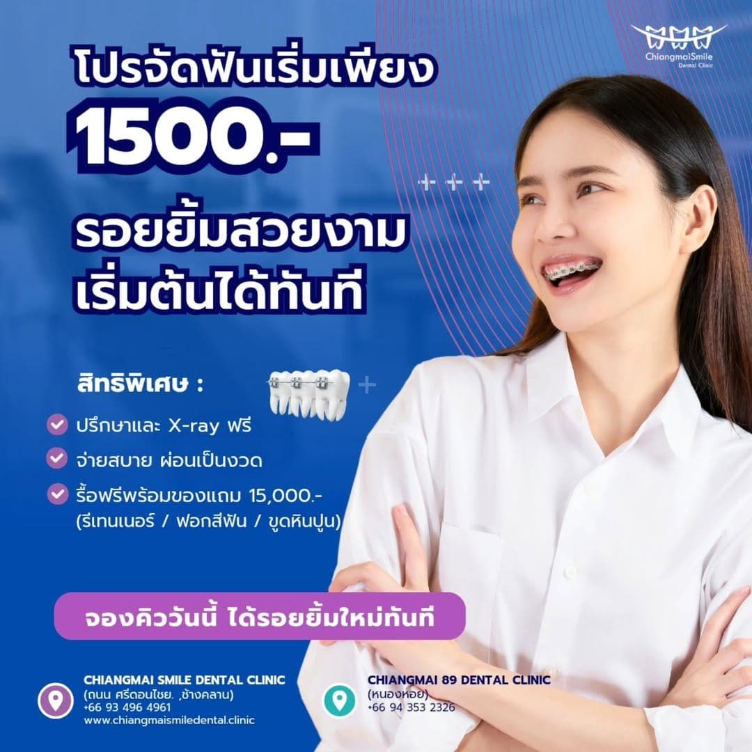 งบเบา ๆ ก็จัดฟันได้ รอยยิ้มใหม่และรูปหน้าดีขึ้นในโปรเดียว!