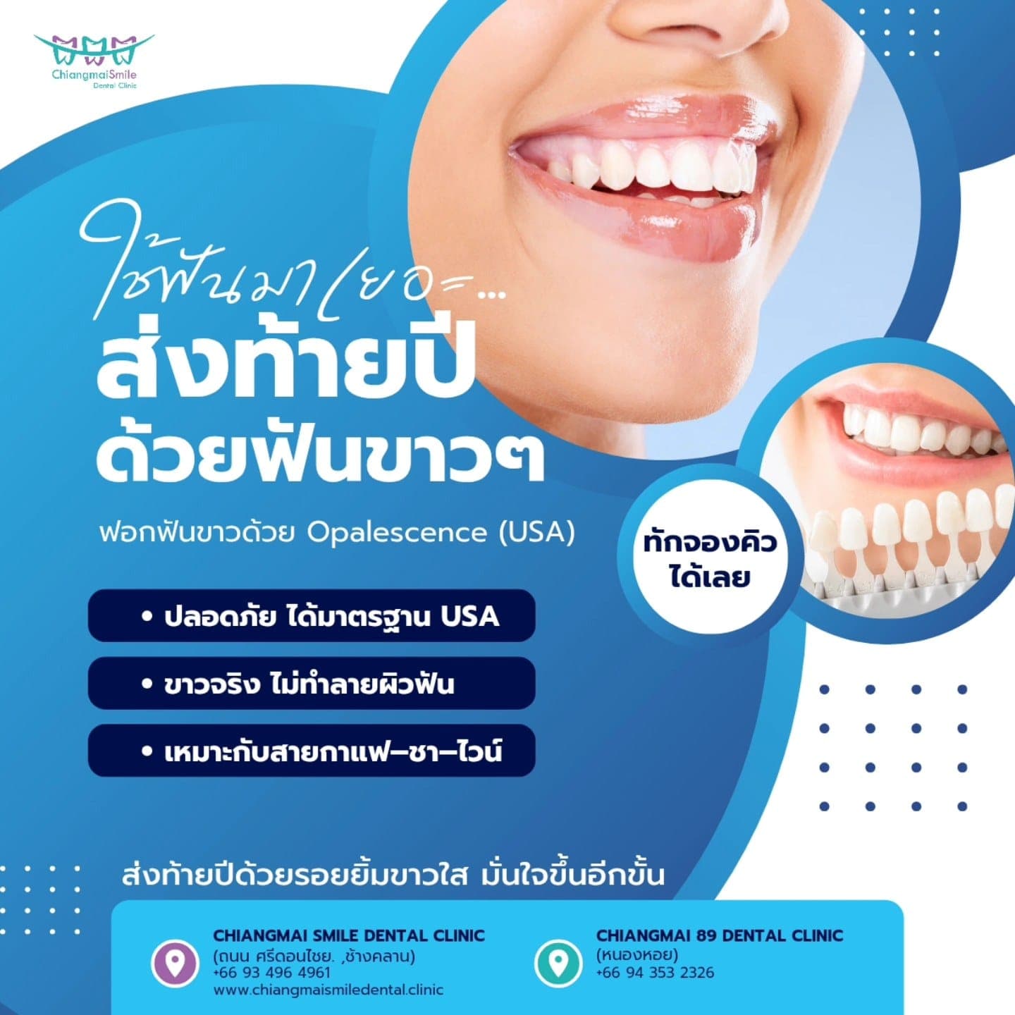 ใช้ฟันมาทั้งปี… ถึงเวลาฟื้นฟูรอยยิ้มแล้วไหม?