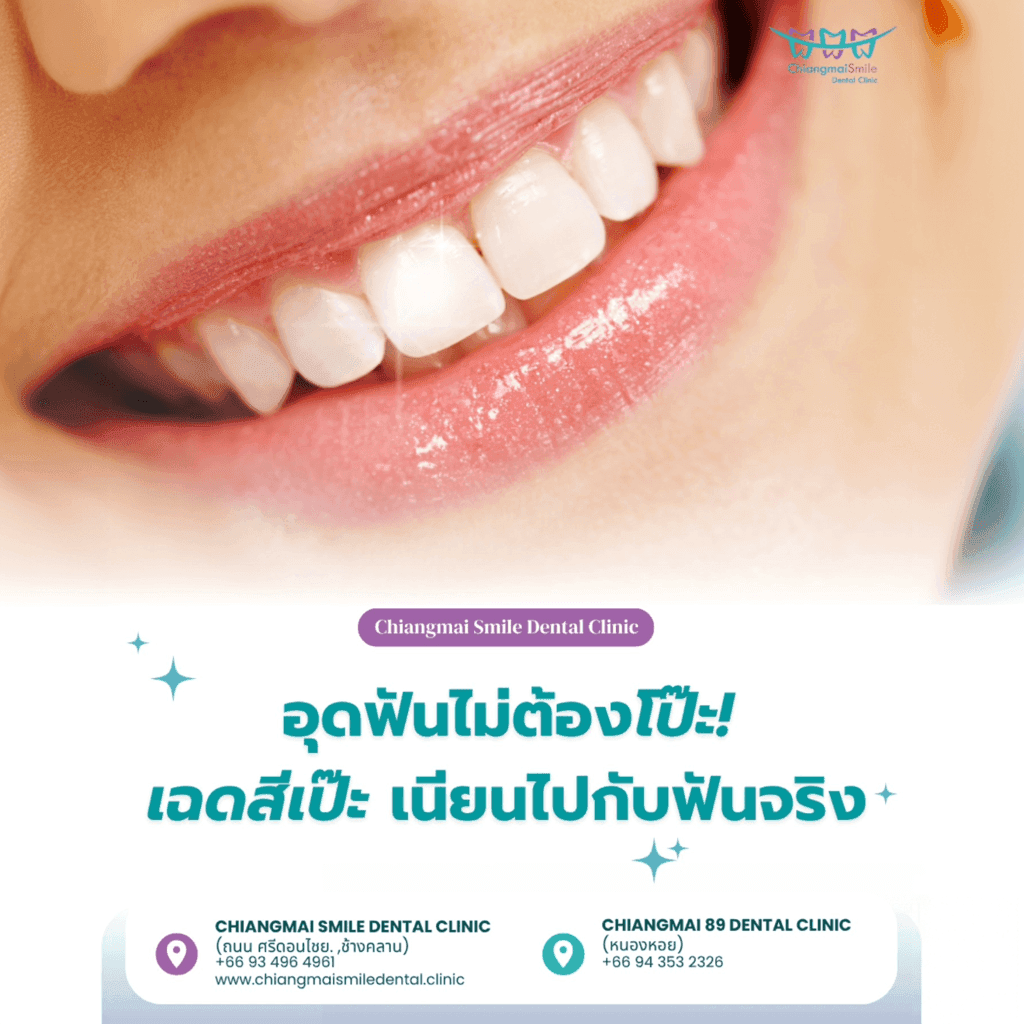อุดฟันสีเหมือนฟัน ดียังไง?