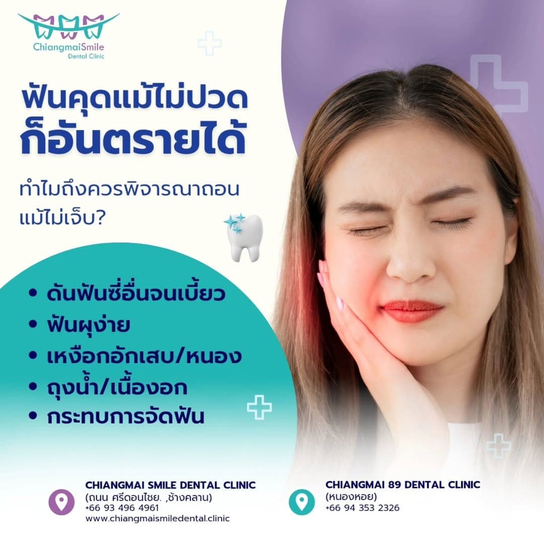 ฟันคุดเเม้ไม่ปวด….ก็อันตรายได้