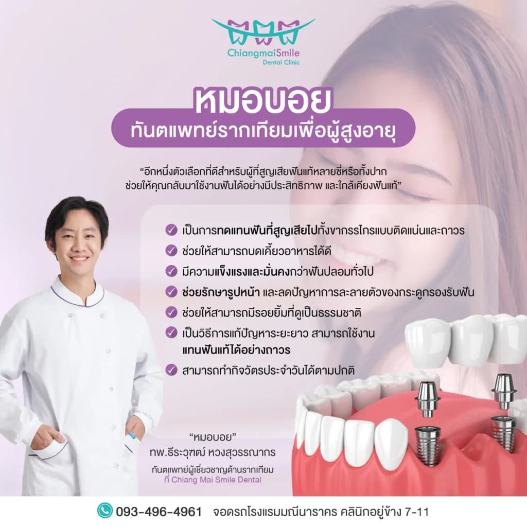 รากเทียม